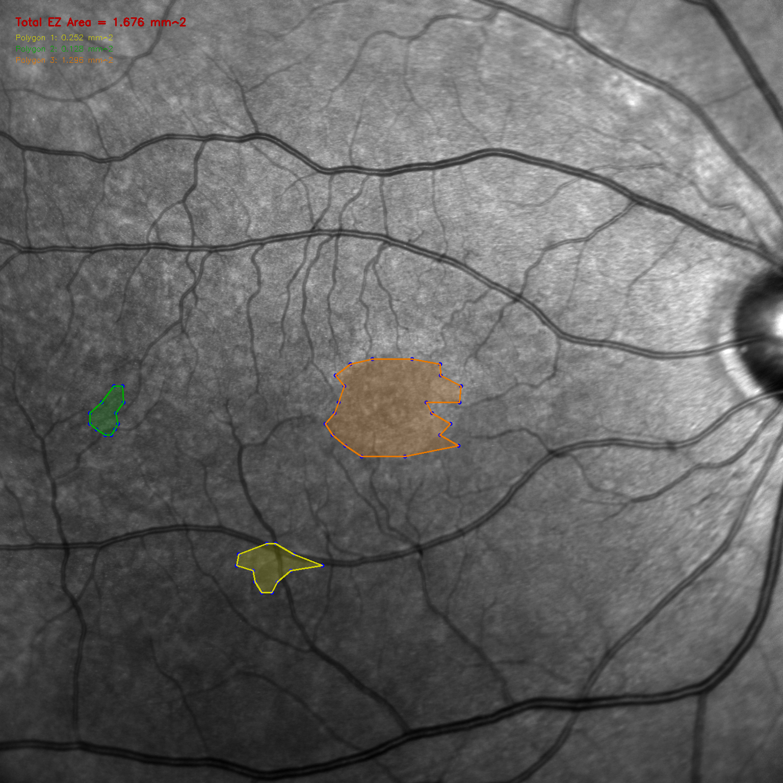 OCT Feature Mapper screenshot